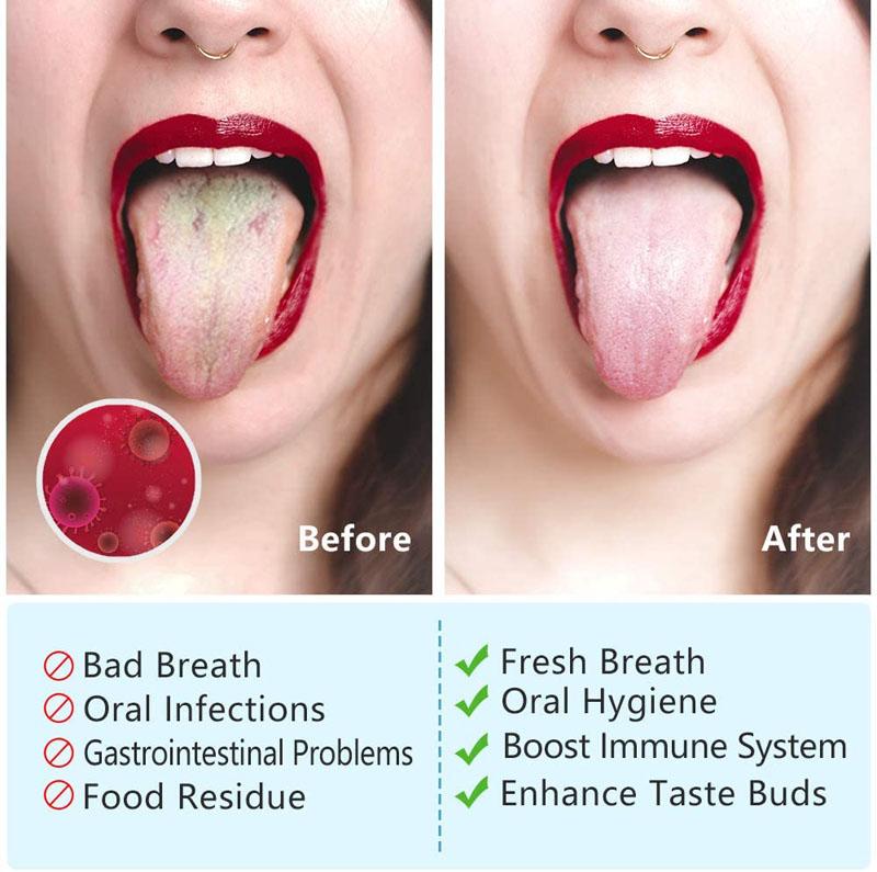 Oral Stainless Steel Tongue Scraper  Banishes Bad Breath And Maintains Gum Hygiene